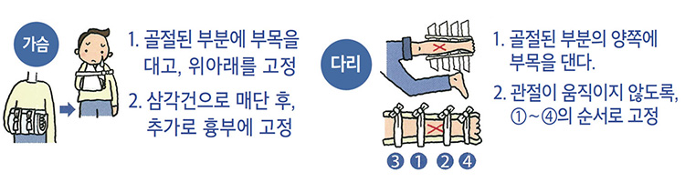 가슴 - 1. 골절된 부분에 부목을 대고, 위아래를 고정 2. 삼각건으로 매단 후 추가로 흉부에 고정, 다리 - 1. 골절된 부분의 양쪽에 부목을 댄다. 2. 관절이 움직이지 않도록, ①~④의 순서로 고정