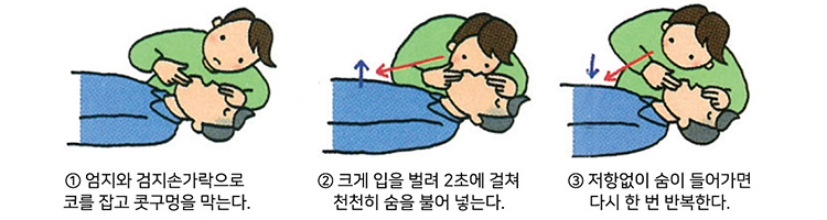 1. 엄지와 검지손가락으로 코를 잡고 콧구멍을 막는다. 2. 크게 입을 벌려 2초에 걸쳐 천천히 숨을 불어 넣는다. 3. 저항없이 숨이 들어가면 다시 한 번 반복한다.